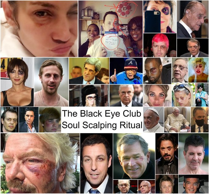 THE BLACK EYE CLUB - SOUL SCALPING SATANIC RITUAL 🍿🐸🇺🇸 SHARE!