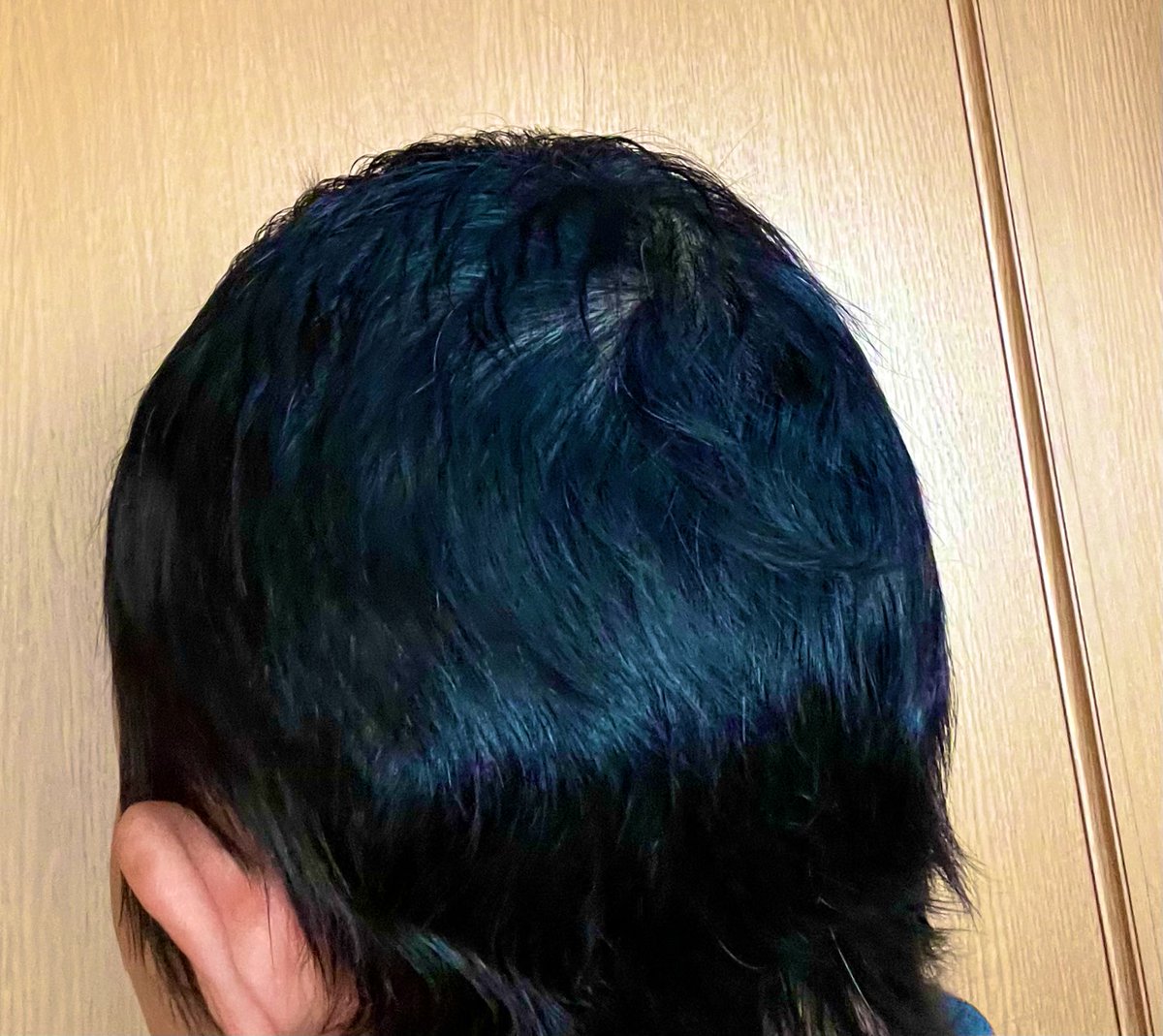 suzu_3m's tweet photo. 抗がん剤終了から5ヶ月
先月と比べと確実に伸びてる😆
髪がクルクルになってきたけど、なんとか伸ばしてみた💦 https://t.co/yHOkIRDZbY