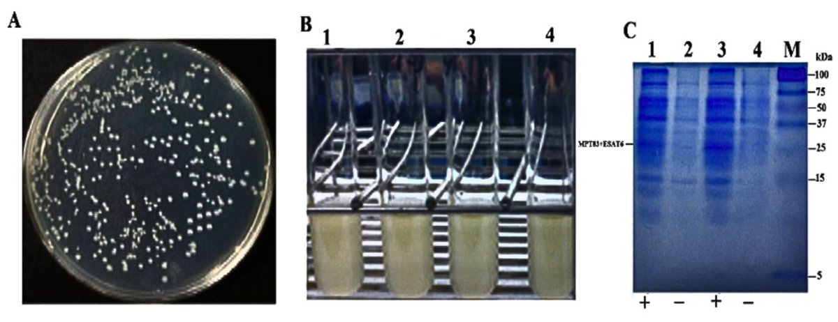 #Cloningexpression, and purification of fusion antigens #MPT83andESAT6 from the local strain of #Mycobacteriumtuberculosis in Escherichia coli as a seed #vaccinecandidate against tuberculosis

doi.org/10.5455/jabet.…