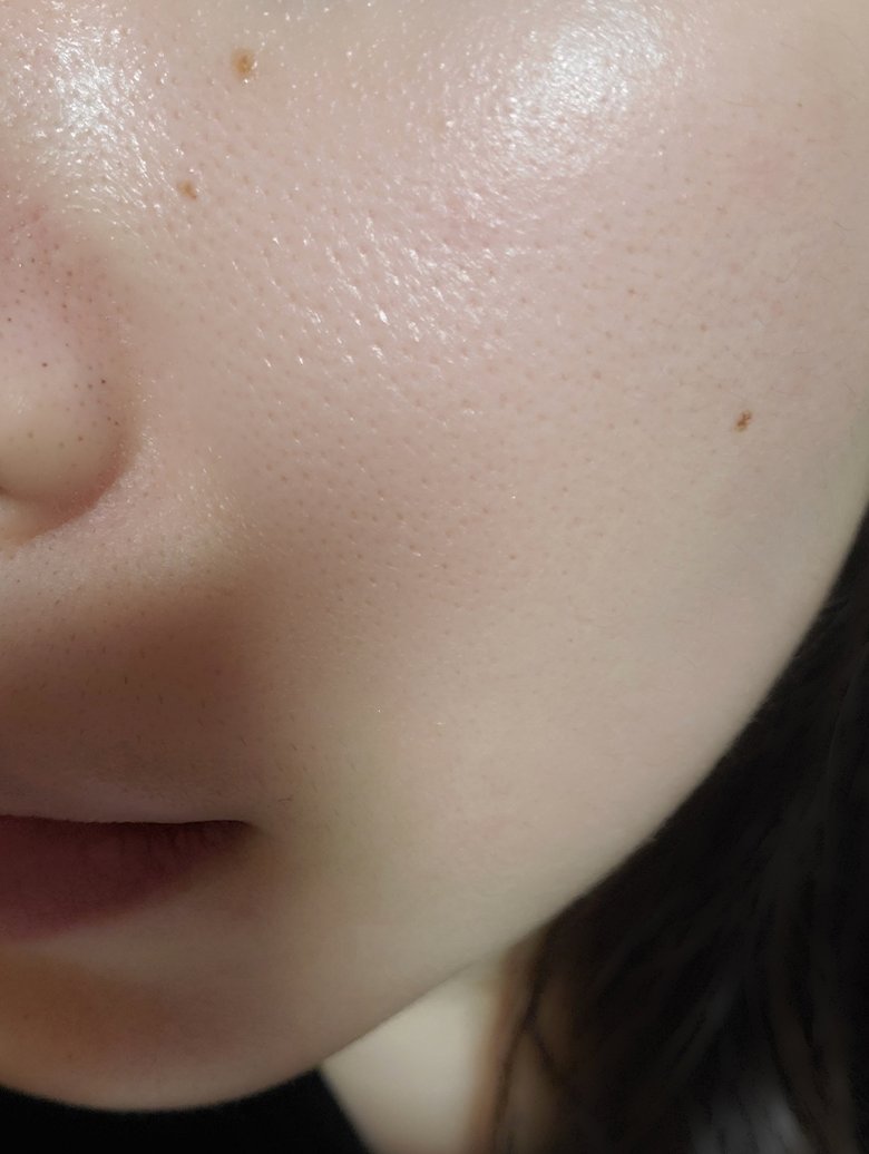 rinna_coscos's tweet image. リアルにめっちゃ変わったから見てほしい。
毛穴開いてたのにここまで目立たなくなったんだよ！！

毛穴気になるときだけ使ってるけど、過剰皮脂と酸化抑えるから黒ずみ減ったし毛穴どんどんちっちゃくなってきてる！！
毛穴ケア色々使ってきたけど、ここまで効果感じたの初めてで感動してる😭😭