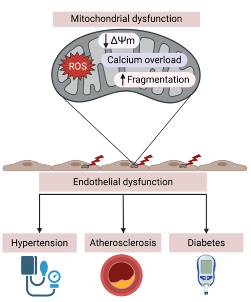 ESC_Journals's tweet image. Are #mitochondria the workhorse of #CardiovascularDisease?

Reviewing the roles of endothelial mitochondrial dysfunction in #hypertension, #diabetes, &amp;amp; #atherosclerosis ow.ly/4kA250XZEWA

@CVR_TomaszGuzik @glenpyle @DrMikeDrozd @Sarah_KBrown #CardiovascularResearch