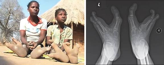 mosongo_'s tweet image. Today I have learnt of the Vadoma tribe of Zimbabwe. White people call them ostrich footed people. This tribe is a direct descendant of the star beings. 
We learn new things everyday.