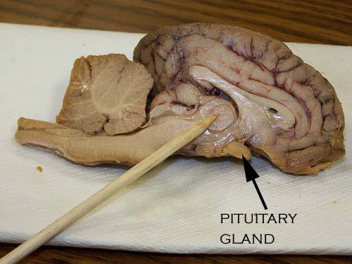 Ya Allah, kelenjar sekecil semini ini punya tugas senjelimet, sekompleks, dan seribet ini? 😭

Gimana gak makin takjub aku tiap belajar ulang anatomi fisiologi 🥹

"Dan (juga) pada dirimu sendiri. Maka apakah kamu tidak memperhatikan?" QS. Az-Zariyat (51): 21