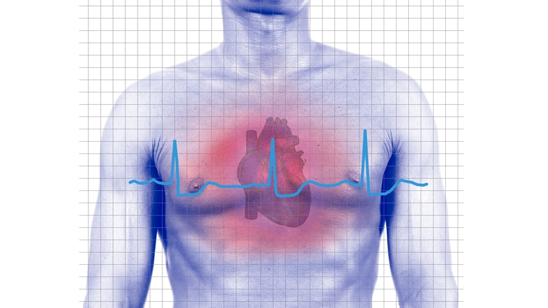 Uso de betabloqueadores após infarto do miocárdio: por que os resultados divergem entre os estudos?
ms.spr.ly/6014QBqCs