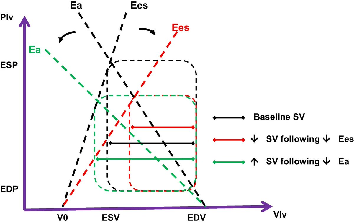 CritCareReviews's tweet image. Today's Paper of the Day is:

Pathophysiological implications of ventriculoarterial coupling in septic shock

criticalcarereviews.com/latest-evidenc…

Join us to read 1 paper per day and stay up-to-date as we cover the spectrum of critical care across 2026