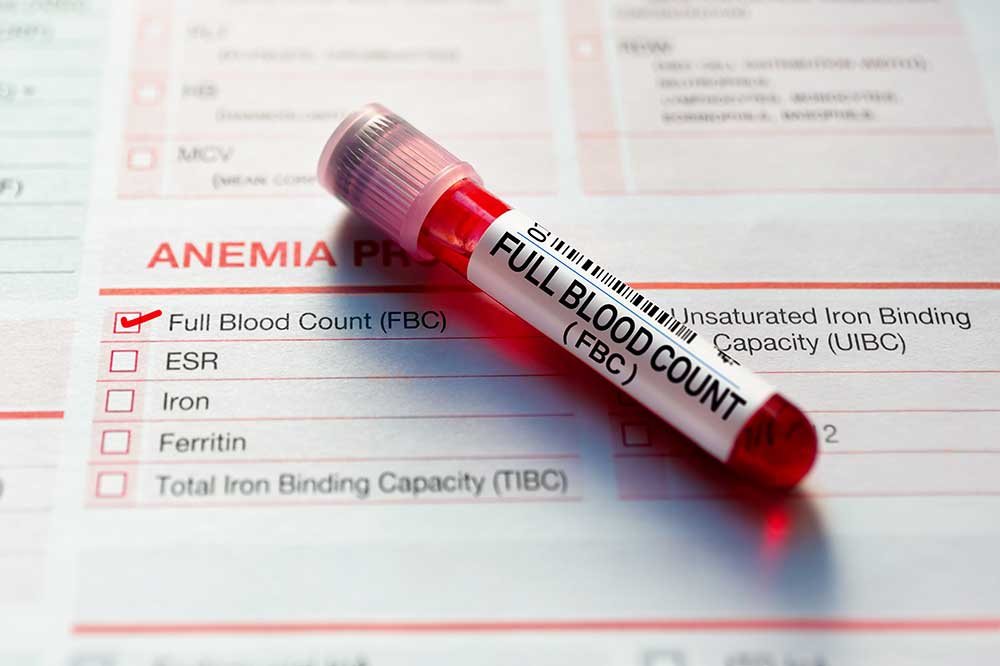 MilanKore's tweet image. Why Full Blood Count (FBC) is usually the first lab test requested ..

Full Blood Count (FBC) is often the first laboratory investigation ordered because it provides a comprehensive overview of a patient's haematological status in a single test.
FBC evaluates the: Red blood cells…