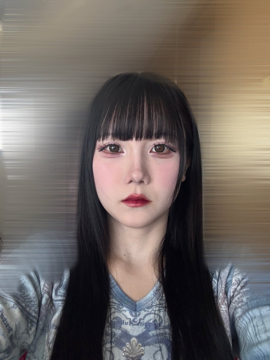 uucha3's tweet photo. 以前は拘縮してて、正面から見た時に鼻の穴が印象的で、鼻の長さも短くなっていました。TikTokでBIKAN整形外科のパク先生を見つけ、症例を見てみたら自然な仕上がりと修正を得意とされていた為、お願いしました。仕上がりがとてもよく周りから自然に良くなったと言われとても満足しました。 https://t.co/bWnnWBs4HP