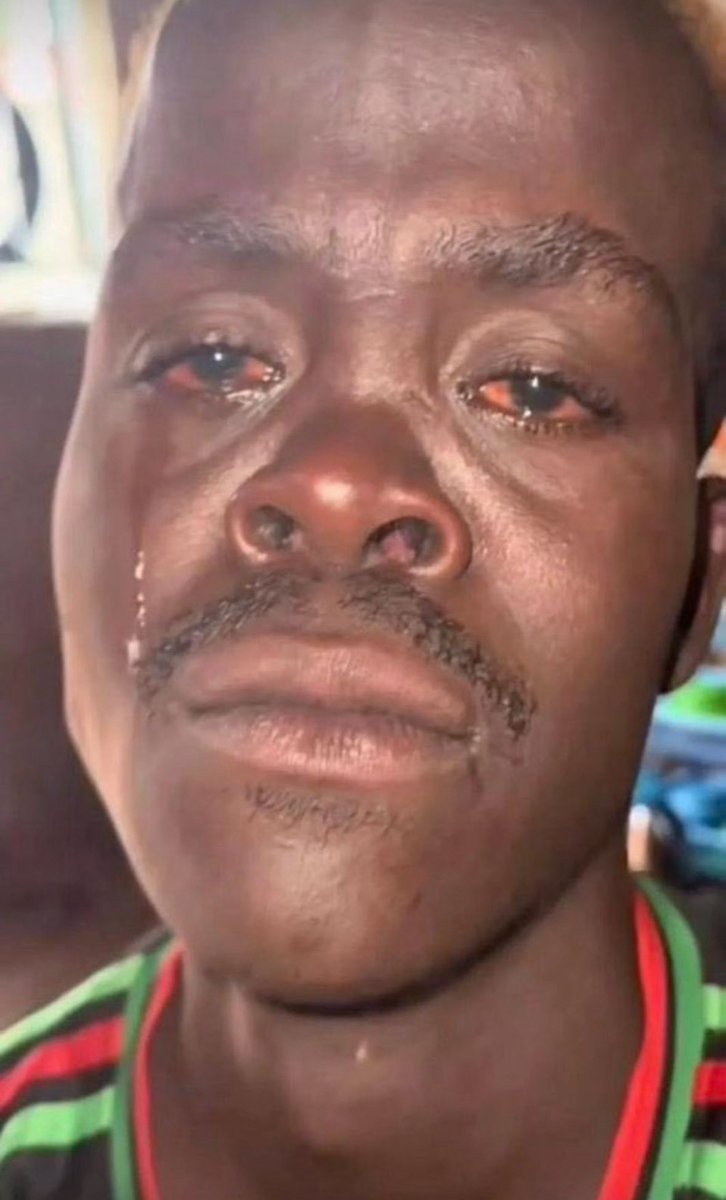 Tunchi_99's tweet photo. Not again bro,abeg you 🤦🏽‍♂️ https://t.co/hWpDtjiJZJ