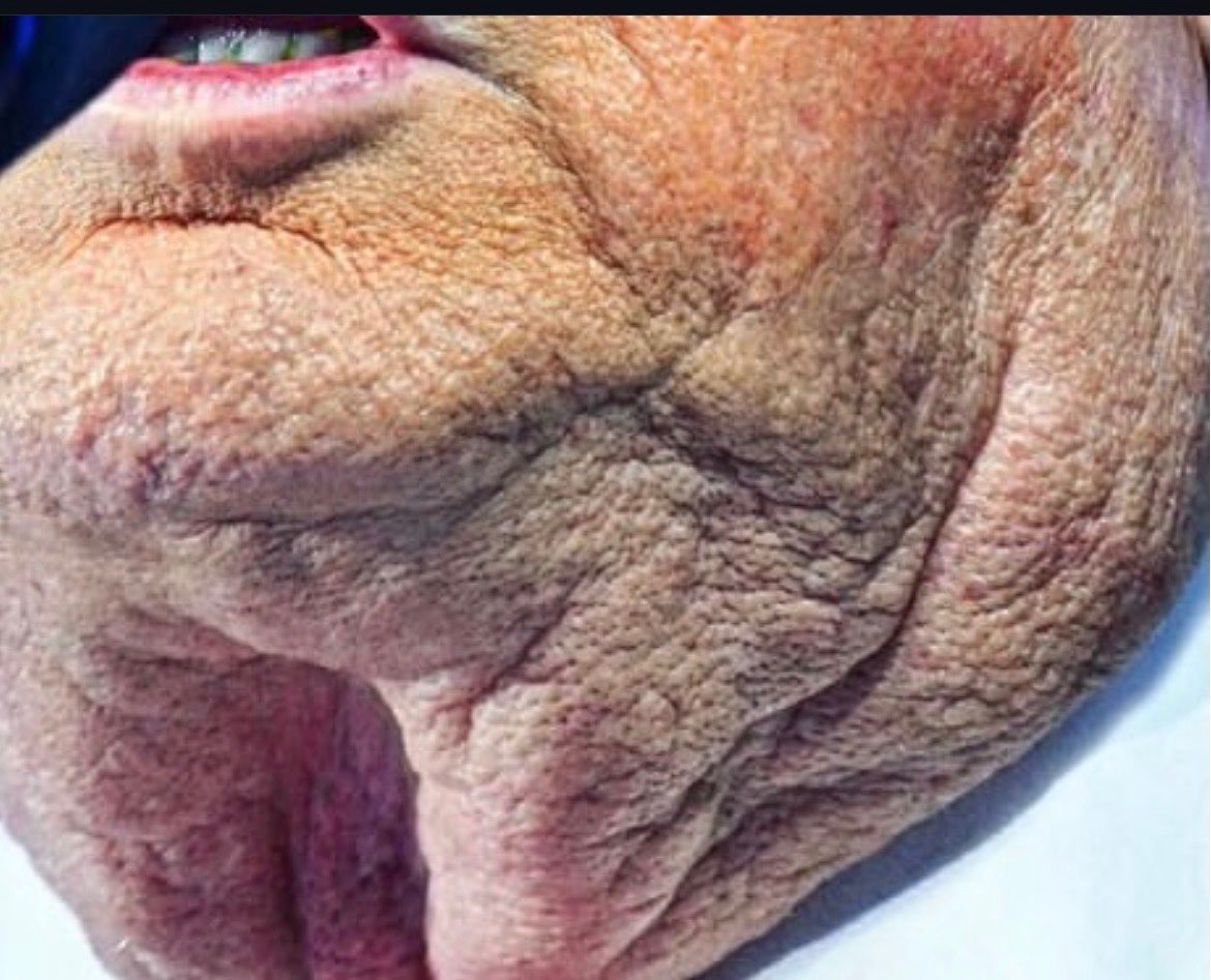 NSFW stands for Neck So Fuckin Weird