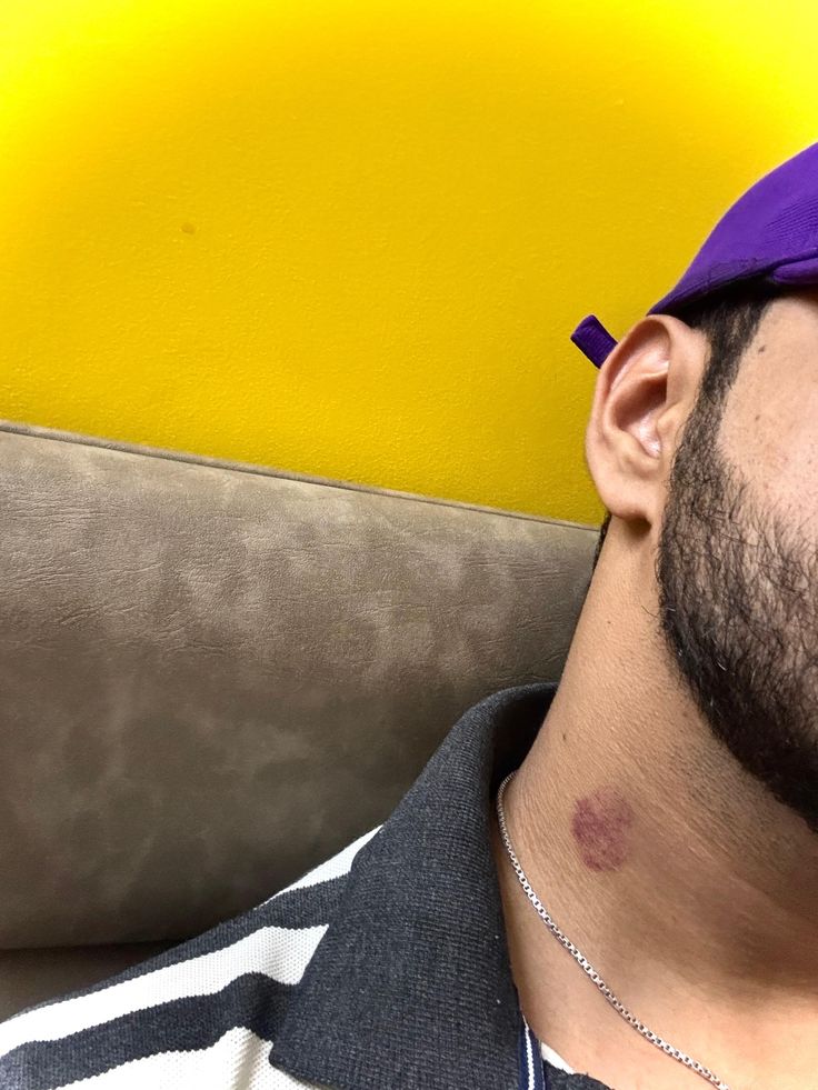 TELGRAM Gurubuna Gelmek İstiyen Tıkla Gel t.me/aksaraysohbet_…

<a href="/gayroskop/">🧭GAYROSKOP🧭</a> <a href="/zevkisefa_77/">coco77</a> <a href="/aaltyaziliporno/">Türkçe Altyazılı Porno</a> <a href="/gaybulucu/">🔎GAY BULUCU🔍</a> <a href="/GayAraBuL35/">İzmir Gay Ara BuL</a> <a href="/scallysex/">Dutch gayfantasy Tweets 🔞🇳🇱 (600K+)</a>
TELGRAM Gurubuna Gelmek İstiyen Tıkla Gel t.me/aksaraysohbet_…