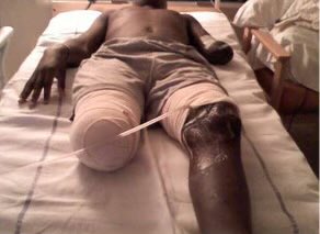 benmcbean's tweet image. Trying to convince myself and my parents I’ll be fine after fighting a bit further back from the front line.