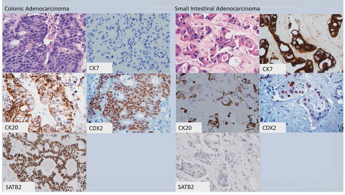 Janira Navarro tweet media