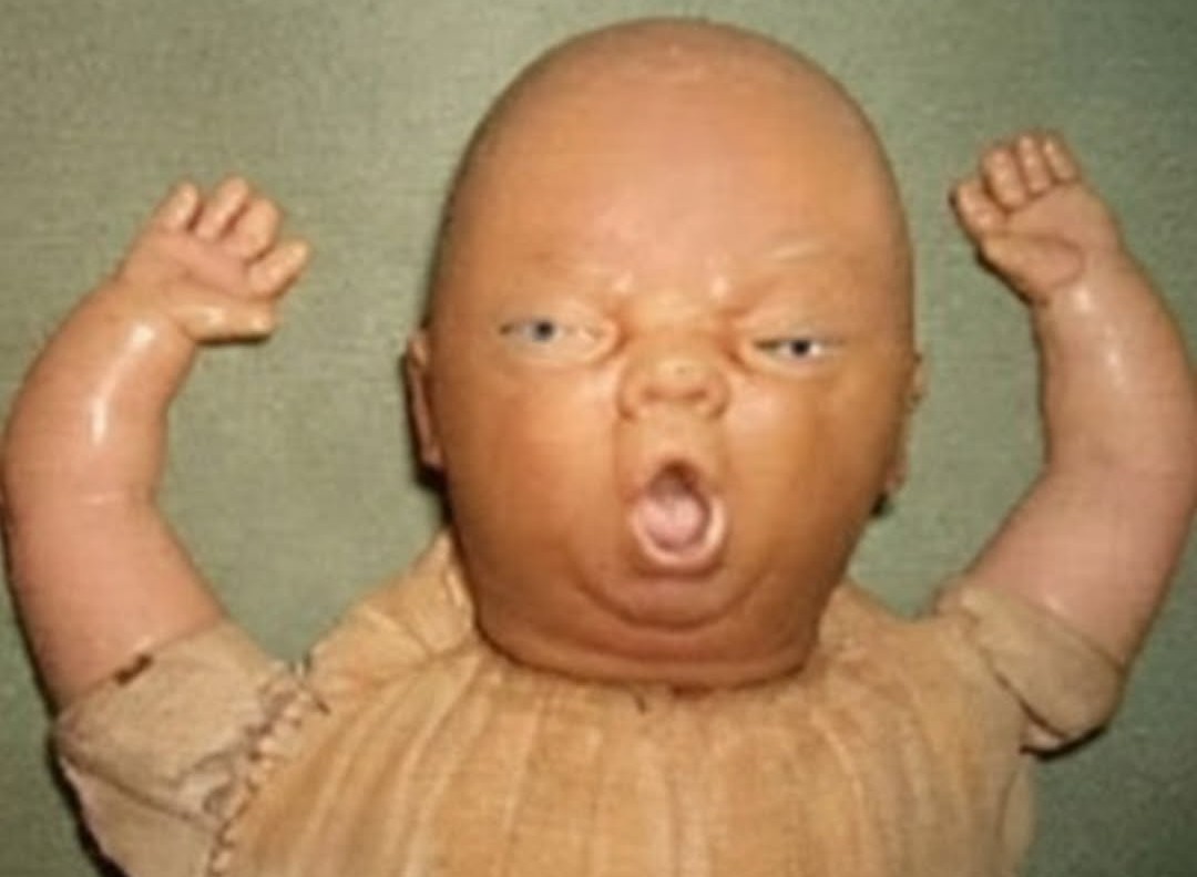 cuando se te fue por el otro canuto y se te esta por salir un pulmón 
te dicen 
-levanta los brazos