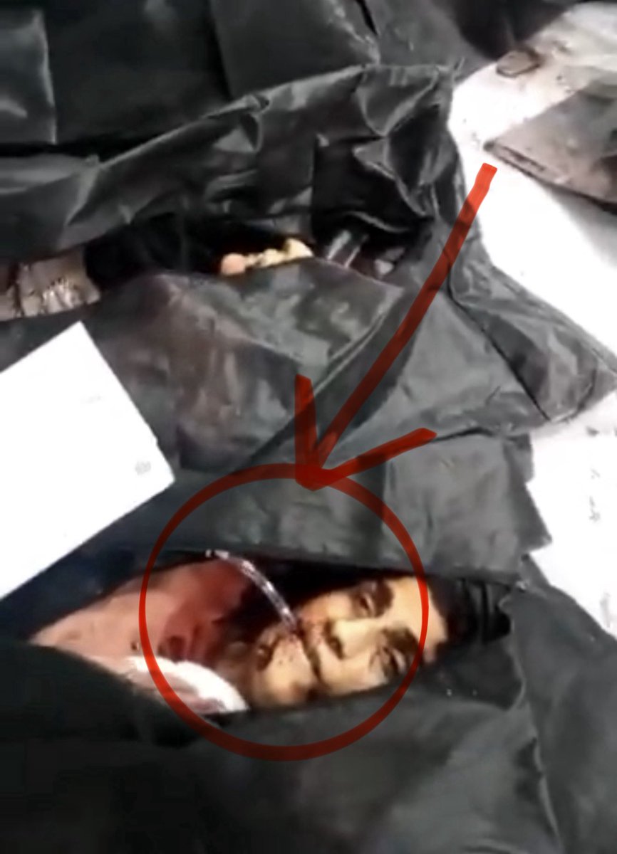 This is one of the thousands of Iranians killed during #IranRevolution2026.

He was lying in a hospital bed with a medical breathing tube in his mouth, a device used to keep the airway open and help patients breathe during critical conditions. This shows he was already injured,