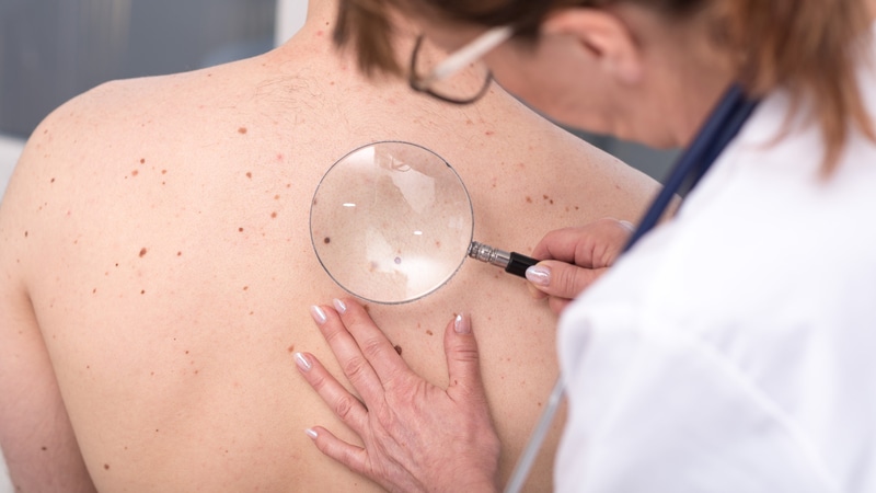 Teste Rápido: Detecção precoce do câncer de pele
ms.spr.ly/6013QDGS1