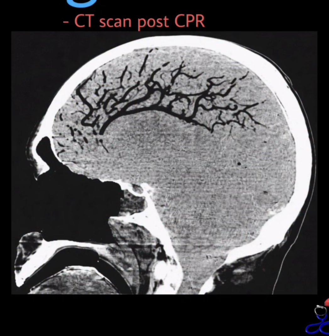 Oren Gottfried, MD tweet media