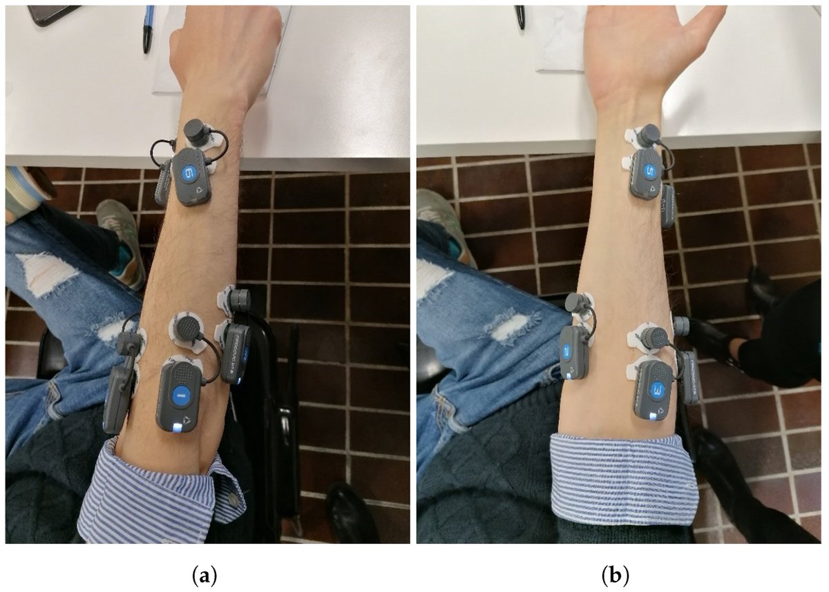 Bioeng_MDPI's tweet image. 💥Highly recommended publication: "Intelligent Human–Computer Interaction: Combined Wrist and Forearm Myoelectric Signals for Handwriting Recognition"
🔗 shorturl.at/cki2r
🏫 @UnivPoliMarche @UnivRoma3 
📌#EMG #handwriting #patternrecognition #featureextraction