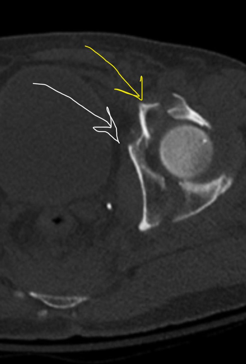 ML Chip Routt tweet media