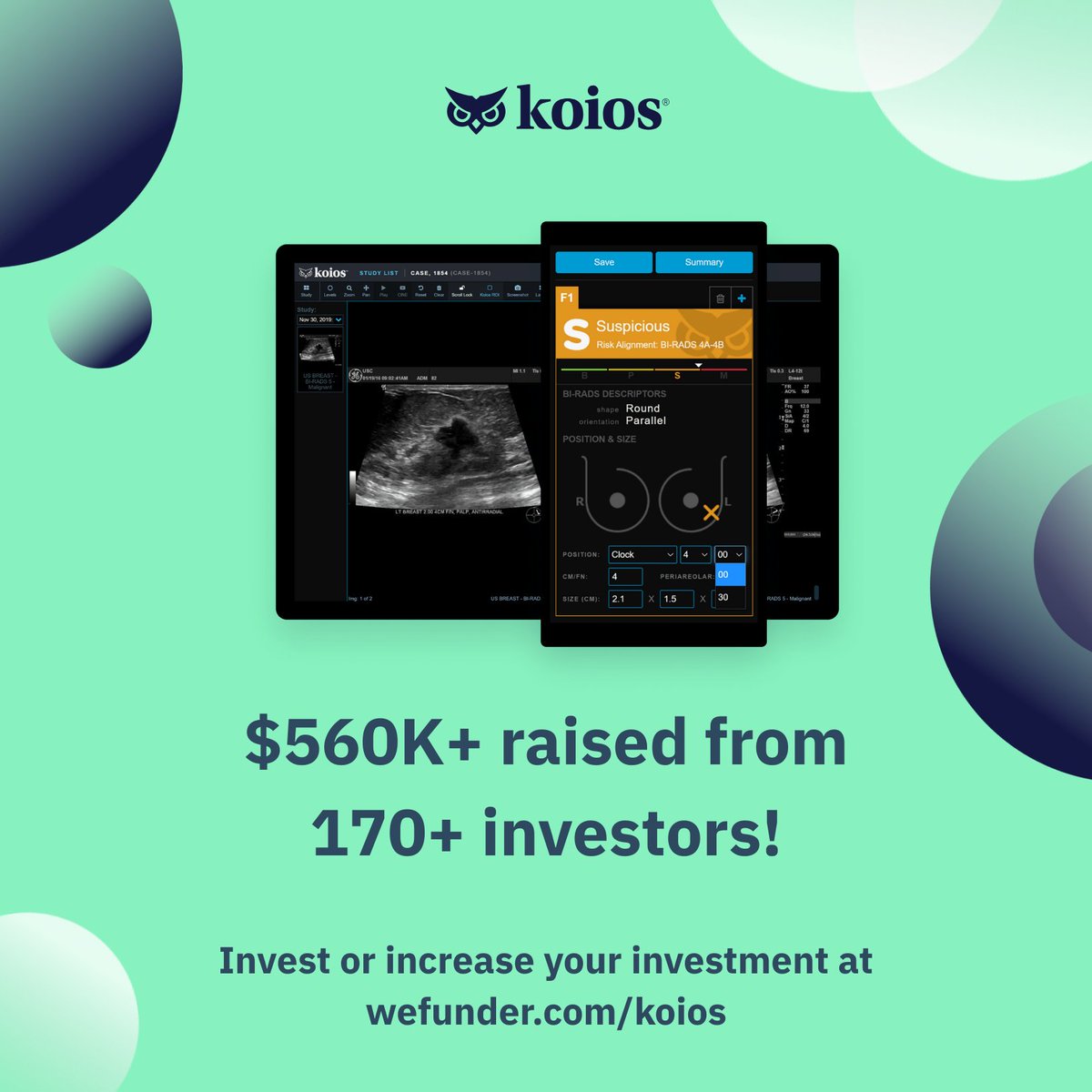 Koios Medical tweet media