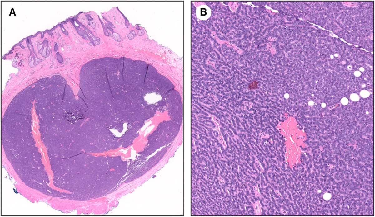 Human Pathology tweet media