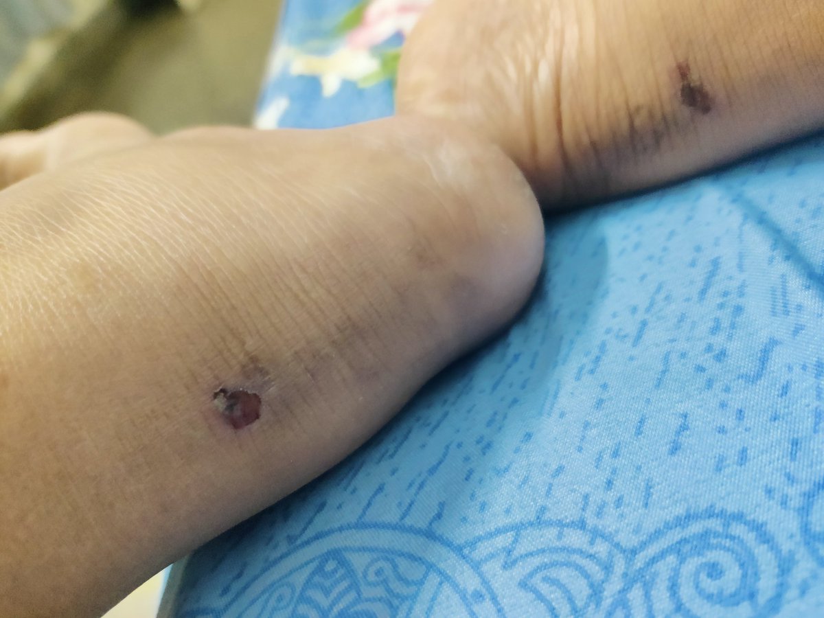 khera_divya's tweet photo. @Flipkart @flipkartsupport 
Dear Flipkart I bought a @PUMA shoes from you, in July 25 never wore it, just started wearing it for my walk and on the second wear I got super serious shoe bite.
Which I don't consider to be normal from a brand like @PUMA 
Tell me what can be done. https://t.co/hnKii55U69