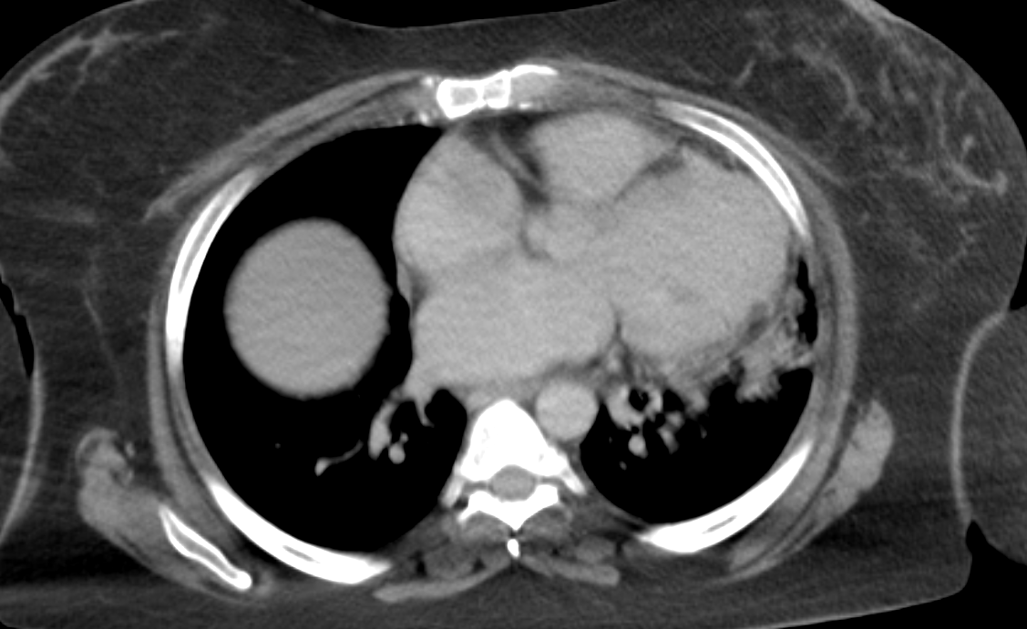 Radiology Bits tweet media