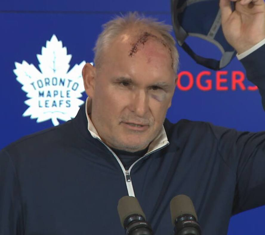 TheHammerHQ's tweet image. Toronto Maple Leafs Head Coach Craig Berube says he got hurt in the gym...

Which exercise are you guessing caused this?
