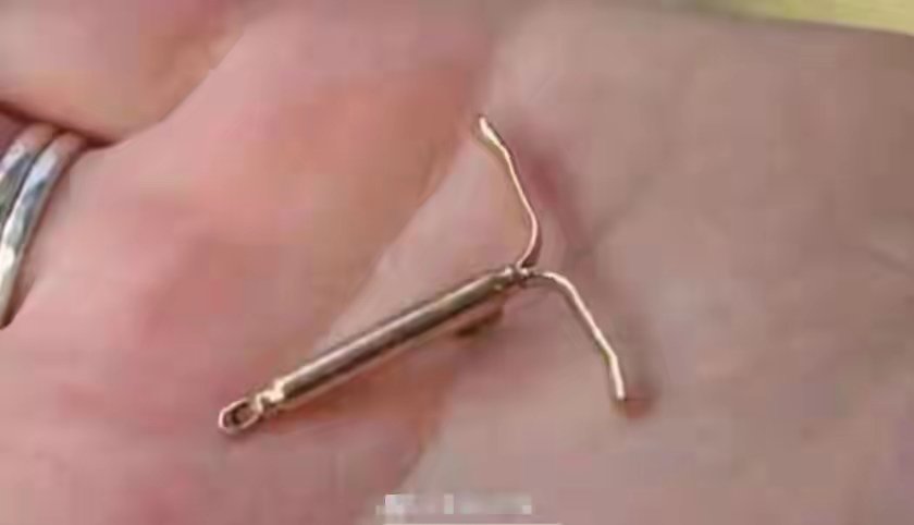 whiteTony99's tweet image. 原来，丹麦也不是什么好东西！其在殖民格陵兰时期犯下的罪行令人发指。从1960年代至1991年，丹麦当局系统性地对数千名格陵兰因纽特妇女和少女实施强制节育政策，主要手段是在她们不知情或未充分同意的情况下，强行植入宫内节育器（IUD，俗称“螺旋”或“避孕环”）。据官方调查确认，至1970年底已有约4070…