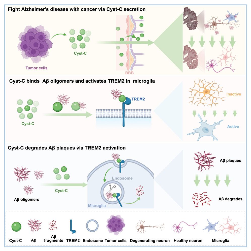 Interesantísimo:
Durante décadas, los científicos habían observado que el cáncer y el Alzheimer rara vez coexistían en una misma persona, lo que había alimentado la especulación de que una de estas patologías podría ofrecer cierto grado de protección frente a la otra
1/3