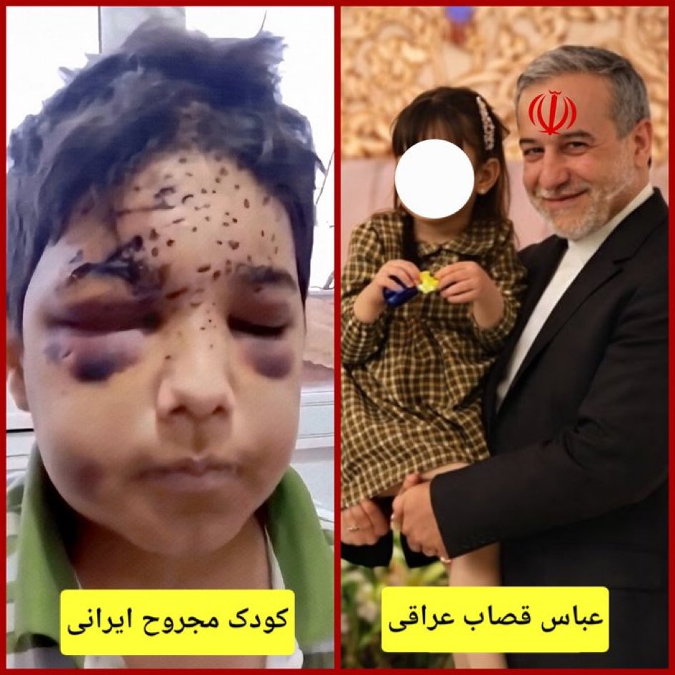 emahpour's tweet photo. Their kids vs our kids
#IranMassacre #IranRevoIution2026 https://t.co/nrt8bau9zq
