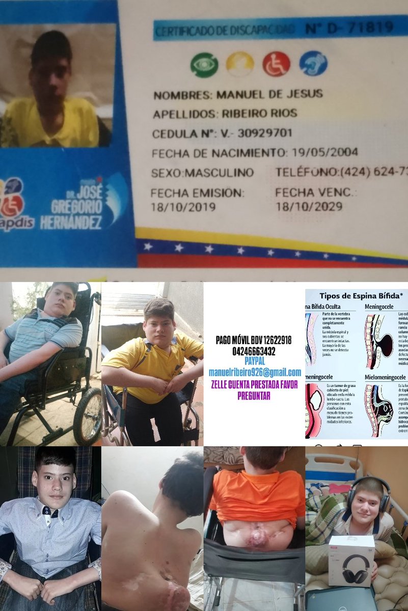 manuel02101's tweet image. Hola 👋 AMERITO TRATAMIENTO DE POR VIDA.       A quienes puedan ayudar, muchas gracias de antemano, 🙏 bendiciones.    PAGO MÓVIL BDV 12622918 04246663432 . PAYPAL manuelribeiro926@gmail.com . ZELLE CUENTA PRESTADA FAVOR PREGUNTAR.  #ESPINABIFIDA #ZULIA