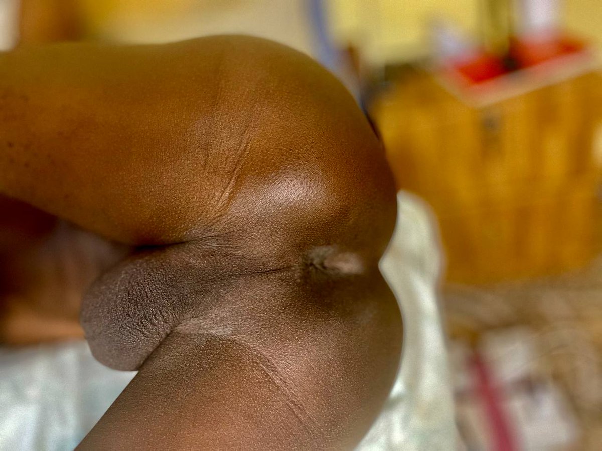 CHOCOMILO tweet media