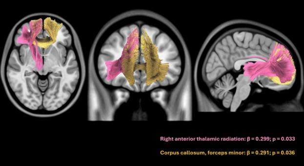 Andrea Slachevsky Chonchol tweet media