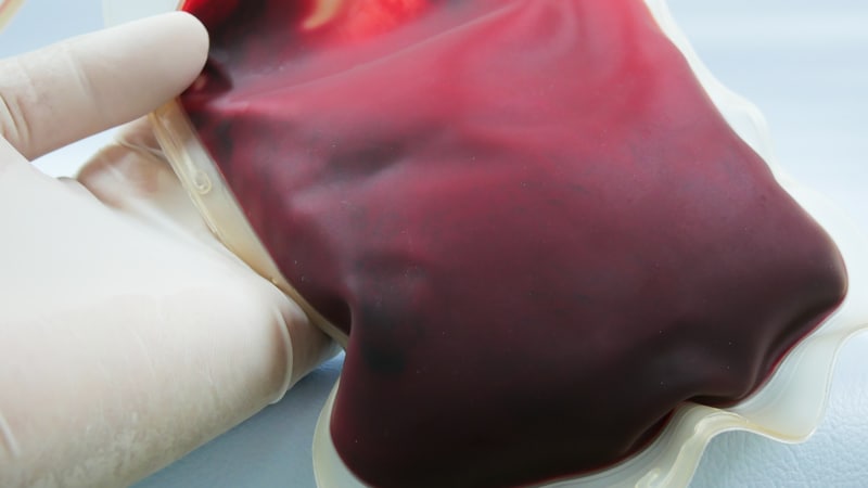 Produção local do CAR-T possibilita o acesso ao tratamento em três semanas
ms.spr.ly/6015QDGSR