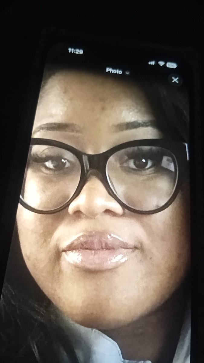 LadyLoved75's tweet photo. THIS CULPRIT THAT NOBODY WILL TURN OVER COMPLETELY DAMAGED MY DAUGHTERS FACE, EACH TIME, WHILE SHE SLEPT! SHES BEEN BEATEN INTO SILENCE.. THEY've crushed her face, took her bottom dimples, aged and spotted her skin.. damaged her eyes.... so much more.. THEY've been doing it 8 yrs https://t.co/VVostONX6c