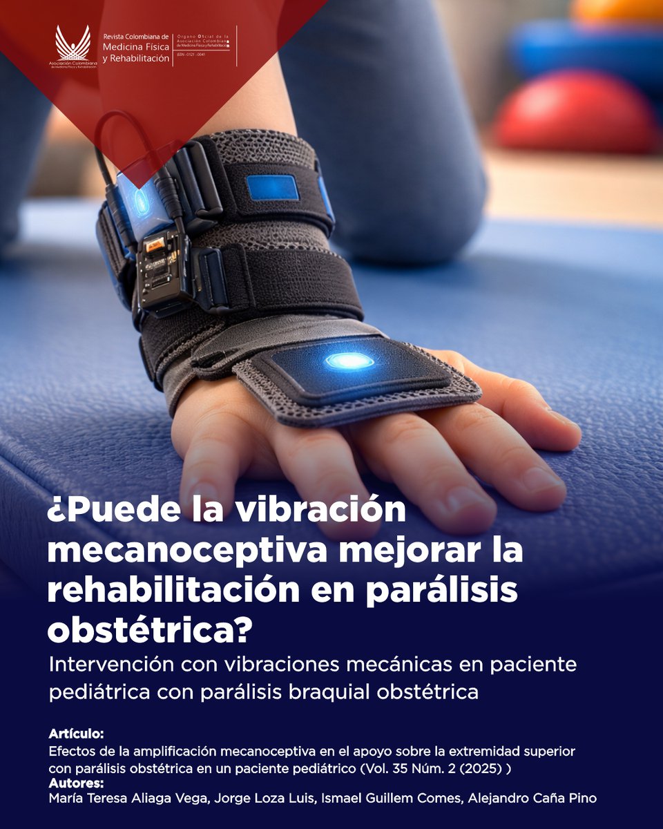 RevistaACMFR's tweet photo. Más tiempo + mayor presión + mejor respuesta motriz. La vibración mecanoceptiva muestra resultados positivos en parálisis braquial obstétrica.
Lee el artículo: https://t.co/l60IeCyeZE
#RehabInfantil #SaludNeuromuscular #CienciaLatam https://t.co/Gj8AdTL826