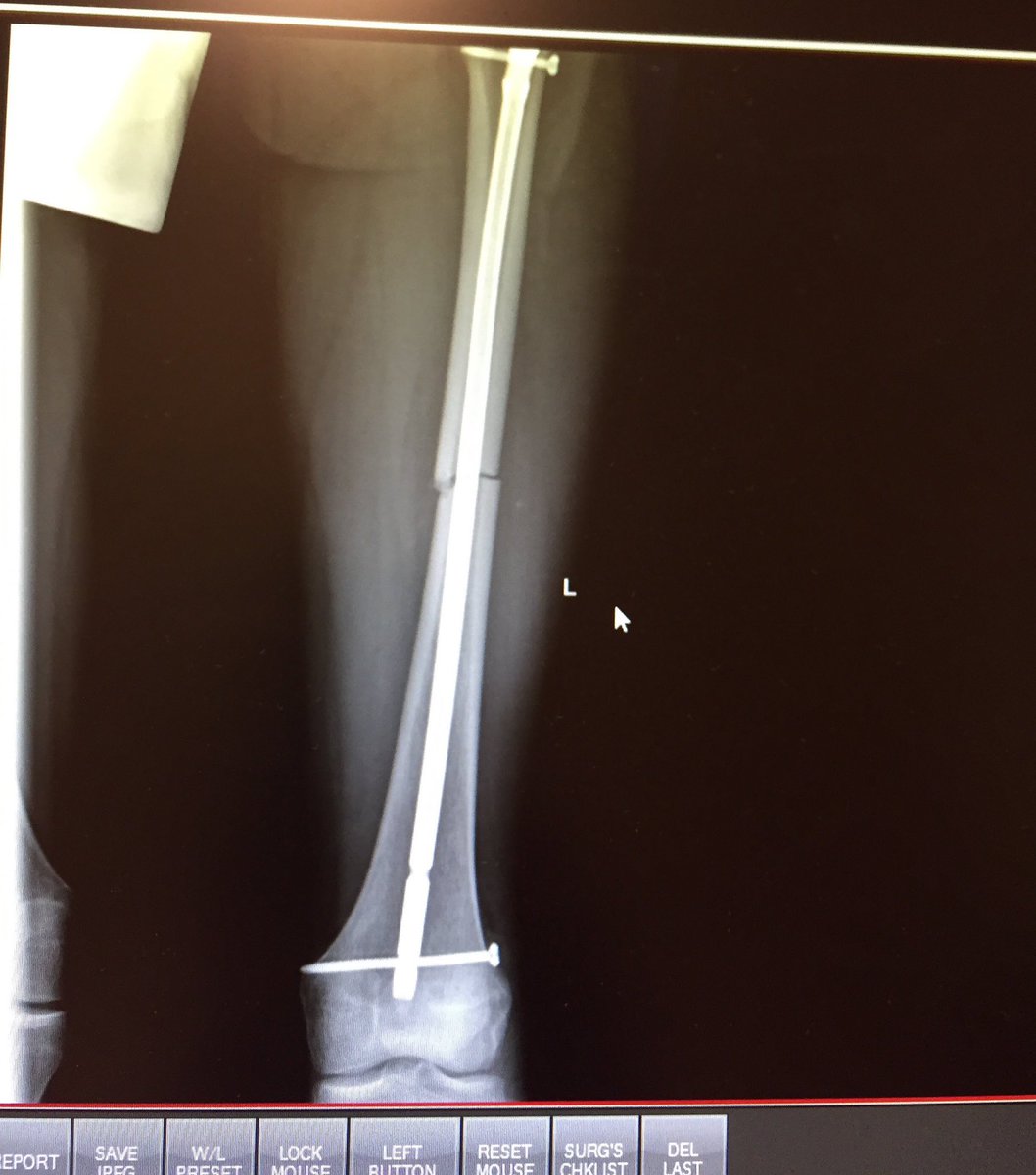 I have that x-ray too kinda