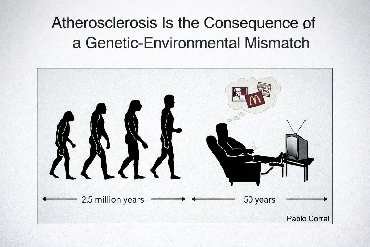 drpablocorral's tweet photo. Human LDL: An Evolutionary Byproduct, Not a Physiological Requirement

📍 Conceptual framework
👉 LDL is not biologically indispensable for most human tissues in adulthood.
👉 Most tissues retain the capacity for autonomous cholesterol synthesis, reducing dependence on circulating LDL.
👉 HDL-mediated sterol delivery plays only a limited and selective role in tissue cholesterol supply.

📍 Metabolic origin of LDL
👉 LDL represents the inevitable metabolic byproduct of hepatic VLDL production.
👉 Hepatic VLDL synthesis is an energetically costly process, not a metabolically efficient pathway.
👉 This system evolved to ensure:
metabolic robustness,
endocrine flexibility,
efficient energy distribution.
👉 These traits were advantageous under ancestral conditions of intermittent nutrition and prolonged ontogeny.

📍 Evolutionary interpretation
👉 The dominance of LDL in human plasma does not reflect physiological equilibrium.
👉 Instead, it represents a supraphysiological state tolerated by evolution.
👉 The deleterious effects of LDL emerge beyond reproductive age, escaping evolutionary pressure.

📍 Clinical paradox
👉 What modern medicine defines as “normal” LDL levels is not biologically optimal.
👉 “Normal” LDL reflects an evolutionary compromise, not a physiological requirement.
👉 Early-life survival and developmental advantages are achieved at the cost of:
lifelong cumulative apoB exposure,
progressive atherogenic burden.

📍 Longevity mismatch
👉 Human lipid metabolism evolved for survival, not for longevity.
👉 Unprecedented human lifespan exposes the pathological consequences of this evolutionary design.
👉 Atherosclerosis emerges as the delayed cost of human metabolic architecture.

@society_eas 
@LipidJournal