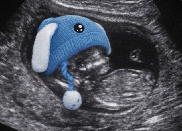 If we start a story saying that ICE detained an unborn baby, could we get Democrats to pretend they care?