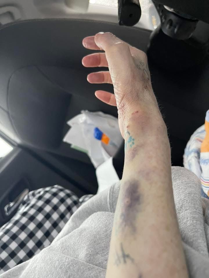 AllTimeJenn's tweet image. When you spend almost a week in the ICU after a stroke and you come home looking and feeling like Gage Creed post semi wreck @MikoHughes #PetSematary