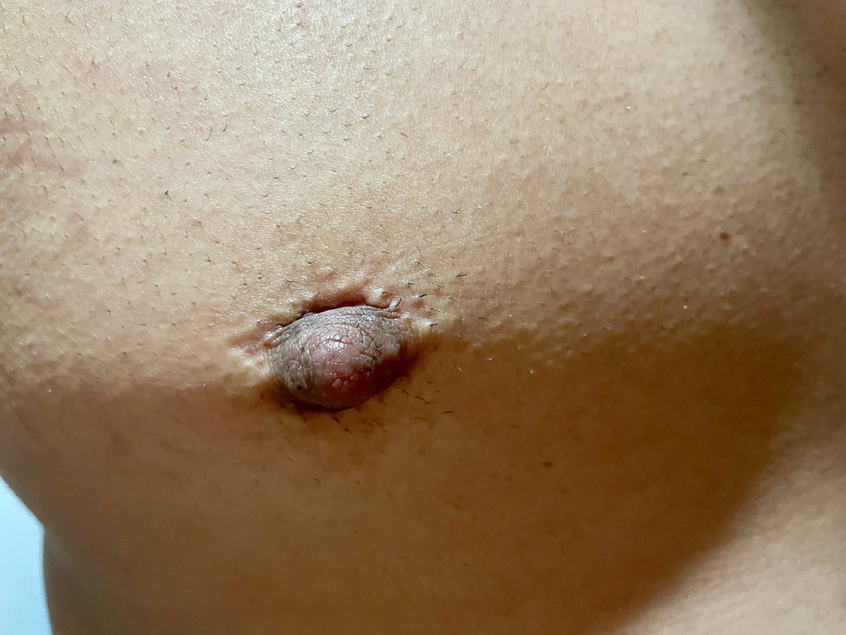 NipSl4ve_AD's tweet photo. So many clamps on my sore nips 🔥 https://t.co/4jt7lmqgAr