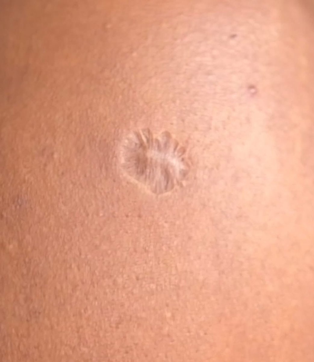 AfiaDimple_'s tweet image. Every Nigerian has this mark 😂🤣