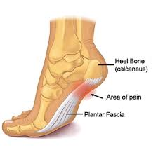 CoachGeoffReed's tweet photo. Read this thread If you have plantar fasciitis pain.

*I believe the most common hidden cause of PF is an imbalance between the gastrocnemius and soleus muscles in the calves*