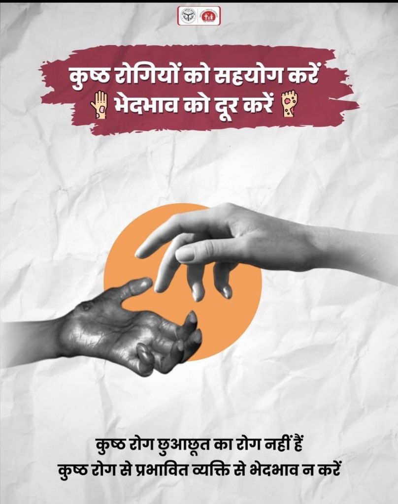 રક્તપિત્ત એ માત્ર એક રોગ નથી, પરંતુ તેની સાથે જોડાયેલા સામાજિક કલંકને કારણે તે એક માનવીય પડકાર બની ગયો છે.

આ વર્ષની થીમ

"Ending Discrimination, Ensuring Dignity"

આપણને યાદ અપાવે છે કે સારવાર માત્ર શરીરની જ નહીં, પણ સમાજની માનસિકતાની પણ કરવાની જરૂર છે.
#LeprosyDay2026