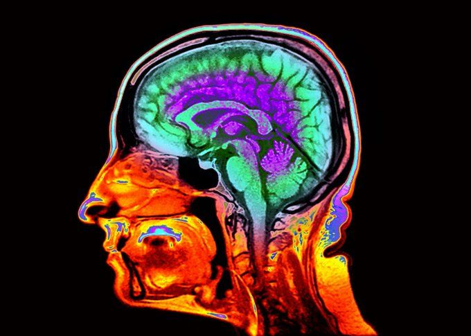 Amir Javadzadeh tweet media