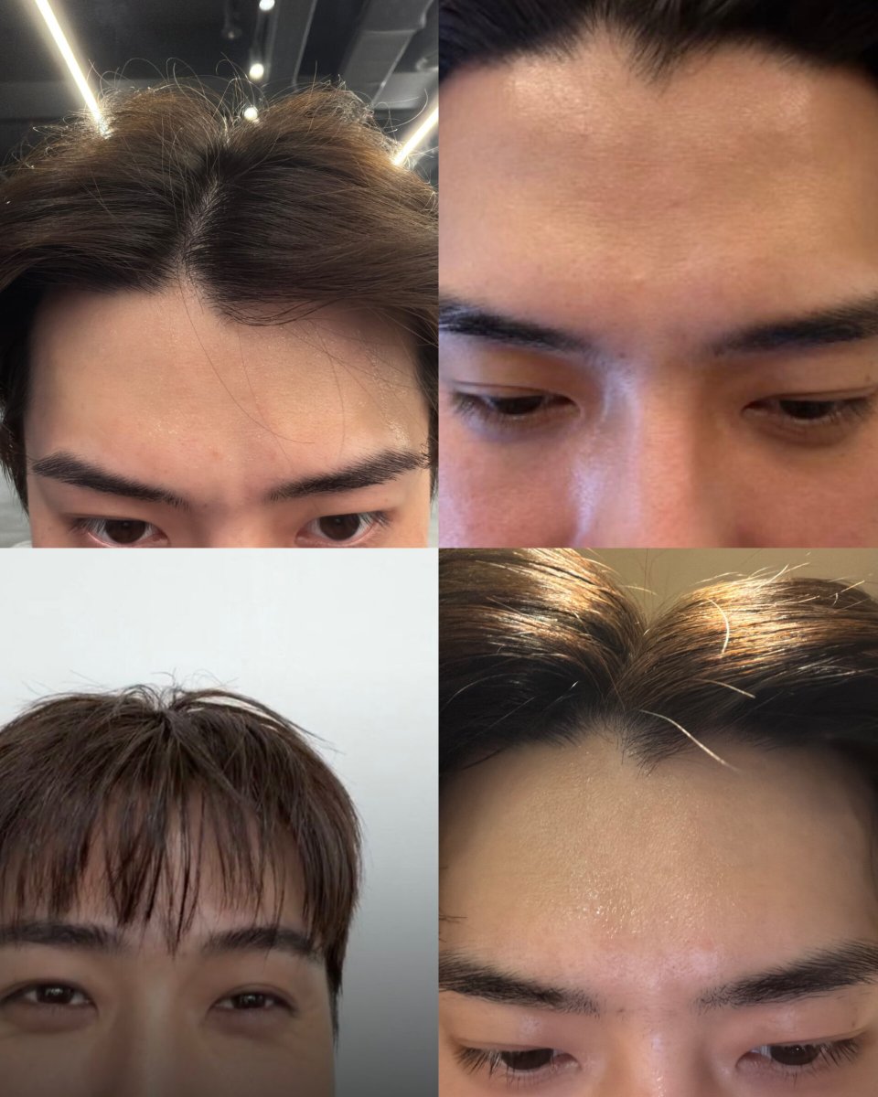 oshcinpcyaaa_'s tweet photo. sehun and his pretty forehead 

#SEHUN #세훈 https://t.co/jQVim81Vje