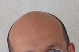 Lillo e Greg Bovino tweet media