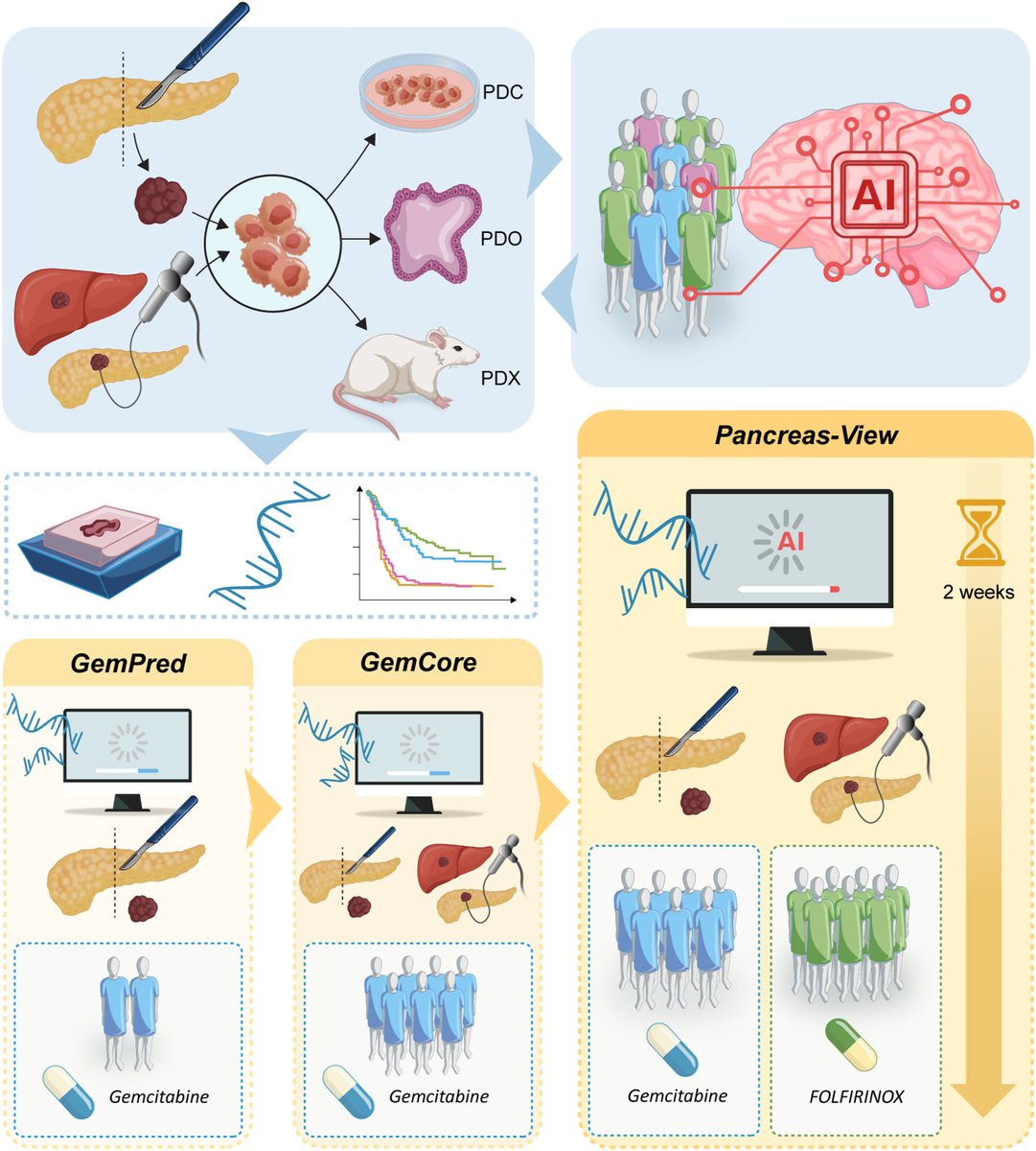 UEGJournal's tweet photo. 🧬 #Transcriptomic signatures enable #precision chemotherapy in pancreatic cancer
🔸Chemo choice in #PDAC remains empirical
🔸GemPred & GemCore predict gemcitabine benefit
🔸AI-based Pancreas-View guides gemcitabine vs FOLFIRINOX
📖 #OpenAccess 👉 https://t.co/BqD9CZKeou https://t.co/sP4xhQu7QR