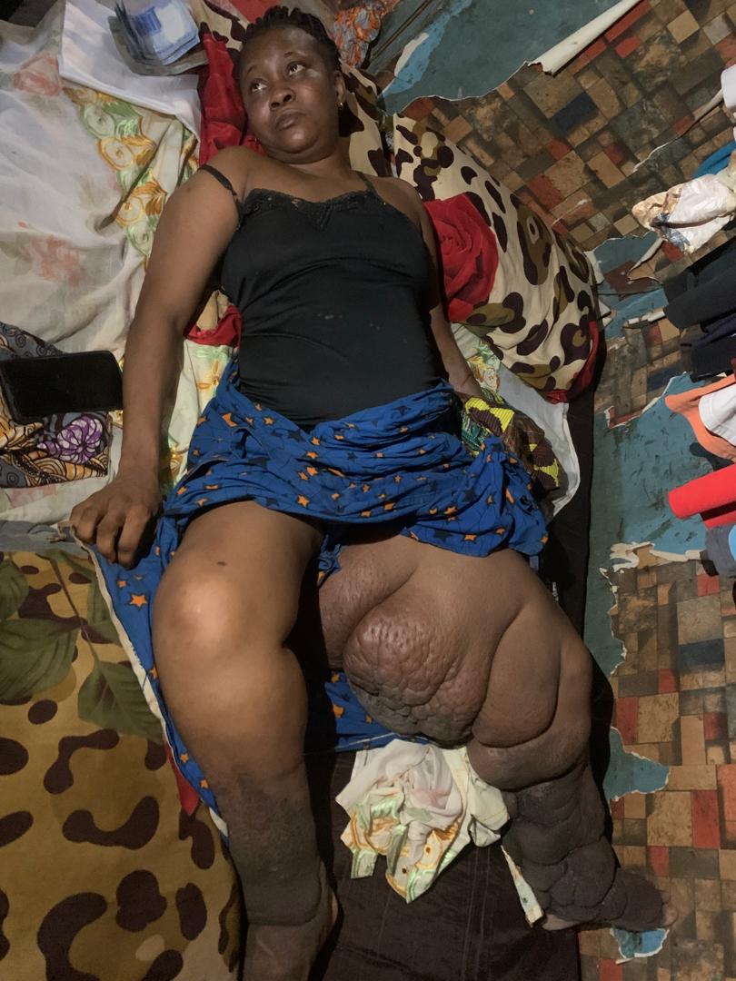 AmakaSuccess15's tweet image. A cry for help!!! 🙏 😭💔😭💔 

My friend Nwamaka is in severe pains. She's from Enugu State, a mother of one. she's going through the worst phase of her life😭😭💔. She's been in this painful condition for a very long time yet no strong solution. 

Pls I'm begging everyone 🙏,…