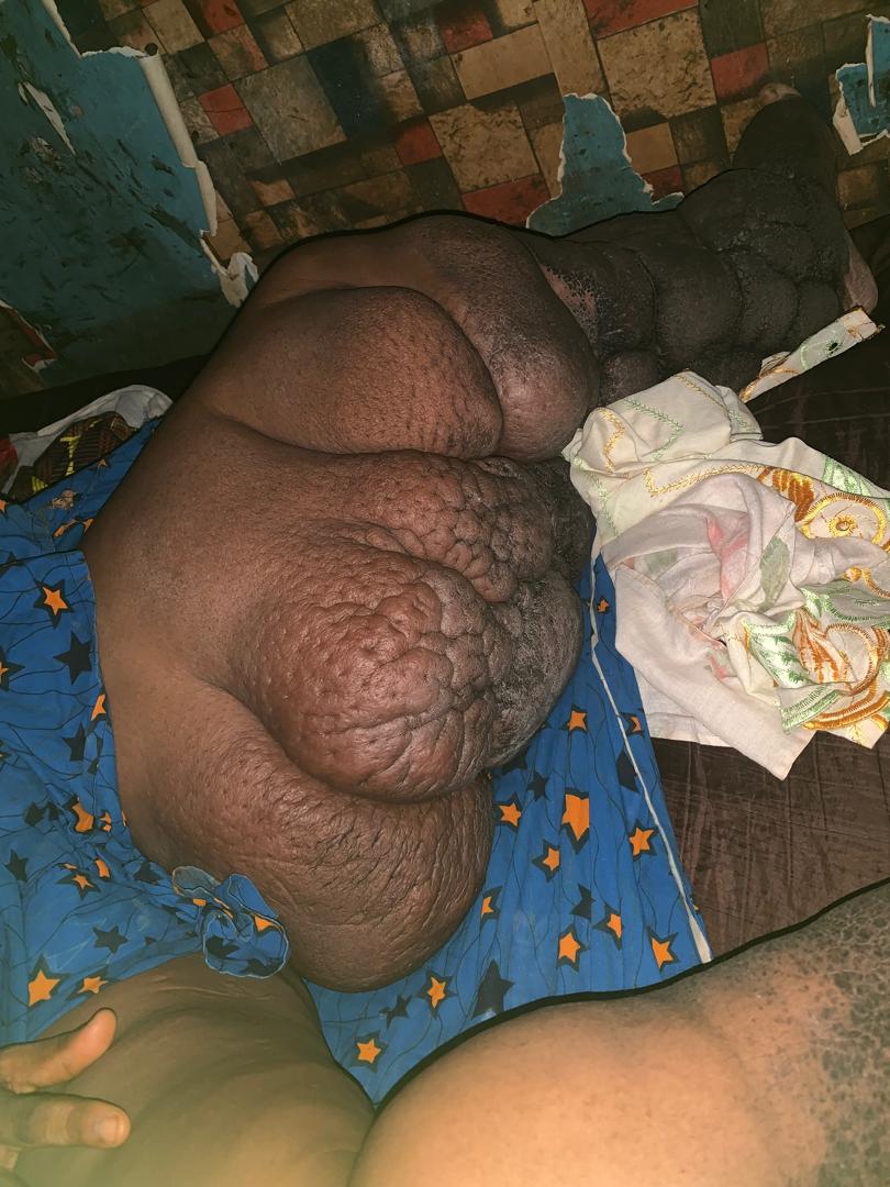 AmakaSuccess15's tweet image. A cry for help!!! 🙏 😭💔😭💔 

My friend Nwamaka is in severe pains. She's from Enugu State, a mother of one. she's going through the worst phase of her life😭😭💔. She's been in this painful condition for a very long time yet no strong solution. 

Pls I'm begging everyone 🙏,…